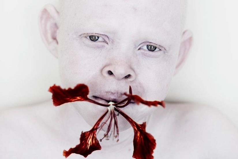 Deadly Whiteness: Incredible portraits of Tanzania's Albinos