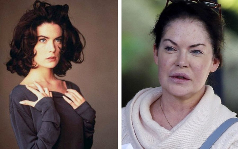 Destroyed a career: 10 stars who failed plastic