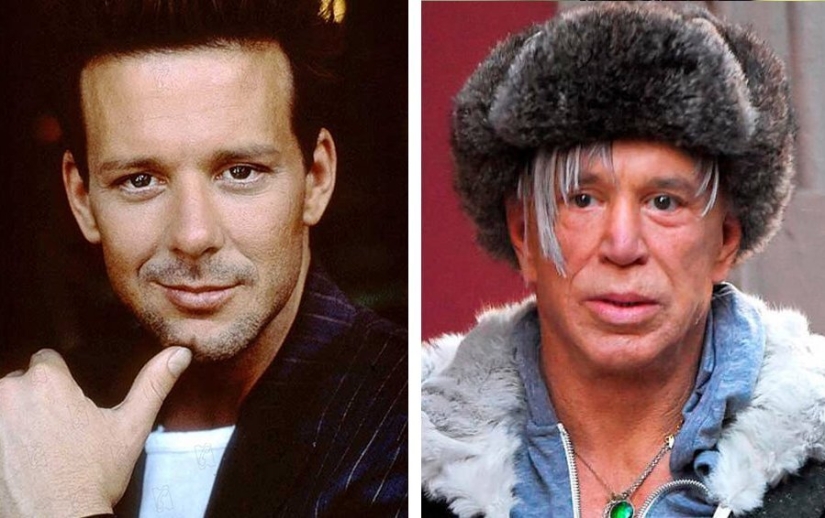 Destroyed a career: 10 stars who failed plastic