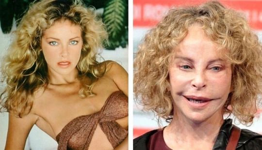 Destroyed a career: 10 stars who failed plastic