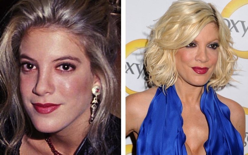 Destroyed a career: 10 stars who failed plastic