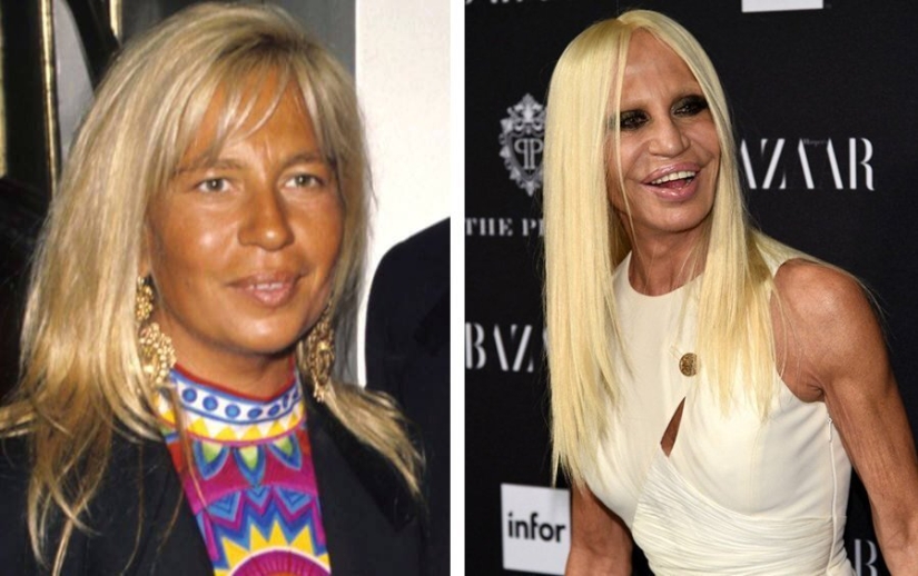 Destroyed a career: 10 stars who failed plastic