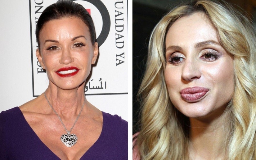 Don’t go to the beautician: 9 most dangerous and useless beauty procedures Don’t go to the beautician: 9 most dangerous and useless beauty procedures