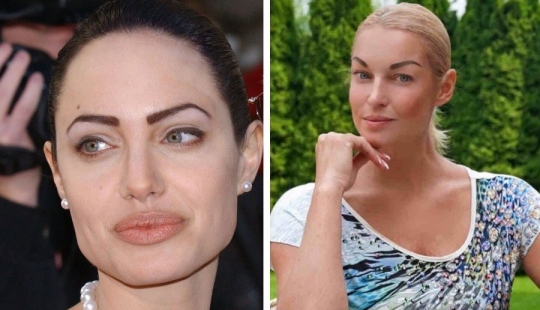 Don’t go to the beautician: 9 most dangerous and useless beauty procedures