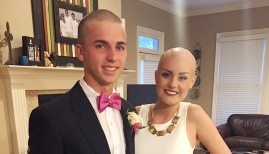 El adolescente se rapó la cabeza en solidaridad con su novia con cáncer