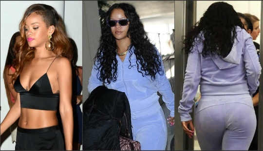 "El hueso era más ancha!": las estrellas del espectáculo, que era delgado, pero es muy recuperado