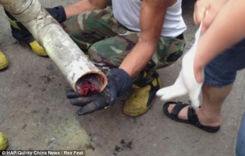 En China, un recién nacido fue rescatado después de ser tirado por el inodoro