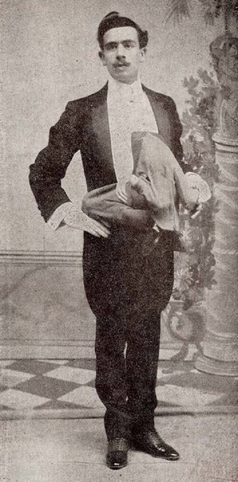 Es difícil de creer, ¡pero estas 5 personas con anomalías realmente existieron! Es difícil de creer, ¡pero estas 5 personas con anomalías realmente existieron!