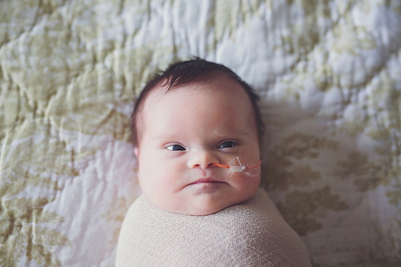 Esta niña tiene un tumor cerebral inoperable, por lo que sus padres le regalaron una sesión de fotos de despedida Esta niña tiene un tumor cerebral inoperable, por lo que sus padres le regalaron una sesión de fotos de despedida
