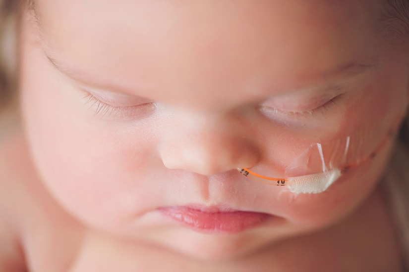 Esta niña tiene un tumor cerebral inoperable, por lo que sus padres le regalaron una sesión de fotos de despedida Esta niña tiene un tumor cerebral inoperable, por lo que sus padres le regalaron una sesión de fotos de despedida