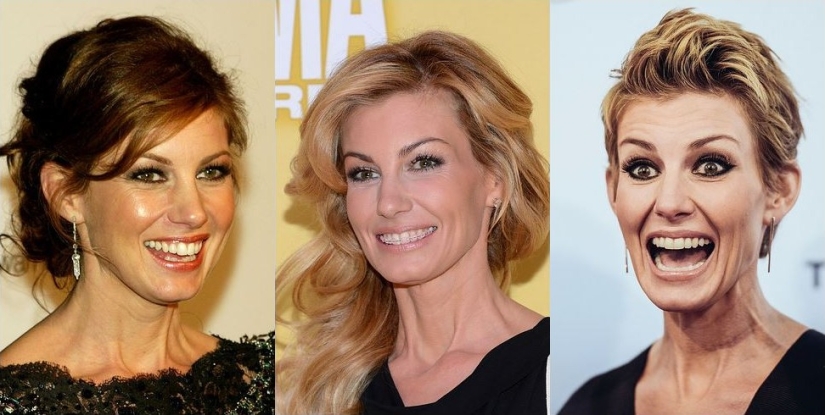 Estas celebridades te mostrarán cómo los frenos pueden cambiar drásticamente tu sonrisa