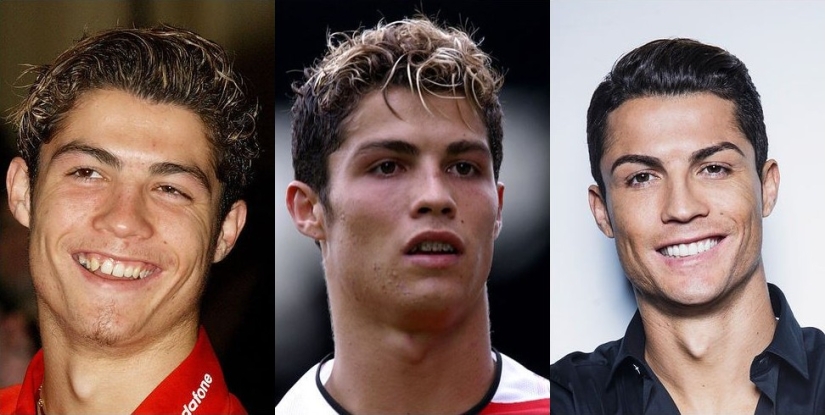 Estas celebridades te mostrarán cómo los frenos pueden cambiar drásticamente tu sonrisa