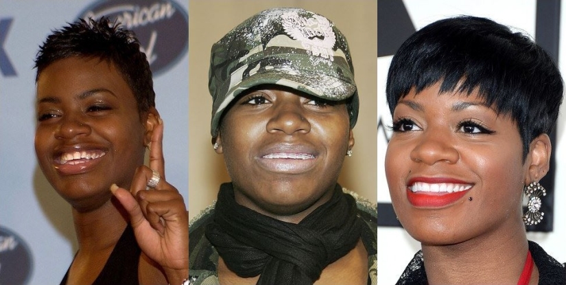 Estas celebridades te mostrarán cómo los frenos pueden cambiar drásticamente tu sonrisa