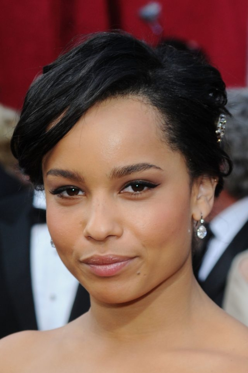 Everyone wants to get rid of them: why are Hollywood stars removing Bish's lumps again and is it necessary to repeat after them? Everyone wants to get rid of them: why are Hollywood stars removing Bish's lumps again and is it necessary to repeat after them?