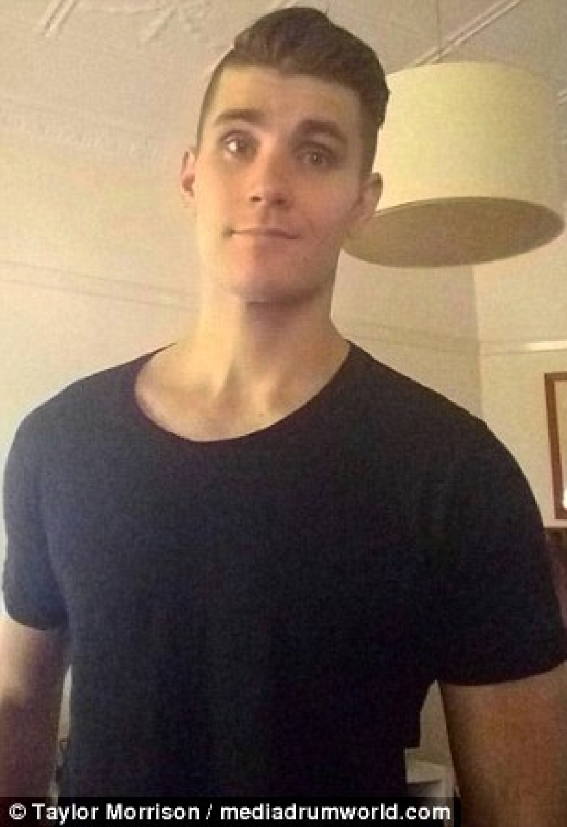 Everything is good in moderation: an obese man lost half his weight and became like Koshchei the Immortal Everything is good in moderation: an obese man lost half his weight and became like Koshchei the Immortal