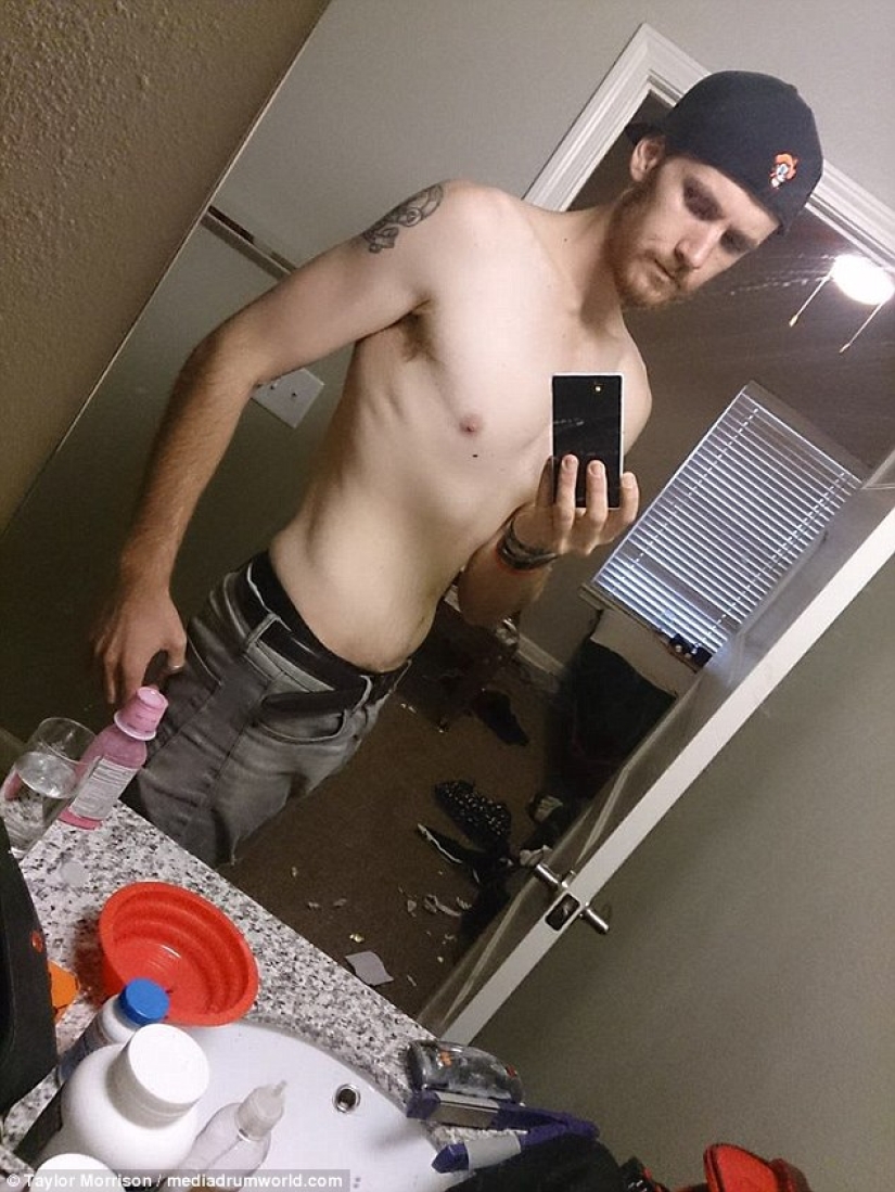 Everything is good in moderation: an obese man lost half his weight and became like Koshchei the Immortal Everything is good in moderation: an obese man lost half his weight and became like Koshchei the Immortal