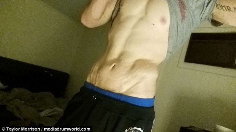 Everything is good in moderation: an obese man lost half his weight and became like Koshchei the Immortal Everything is good in moderation: an obese man lost half his weight and became like Koshchei the Immortal