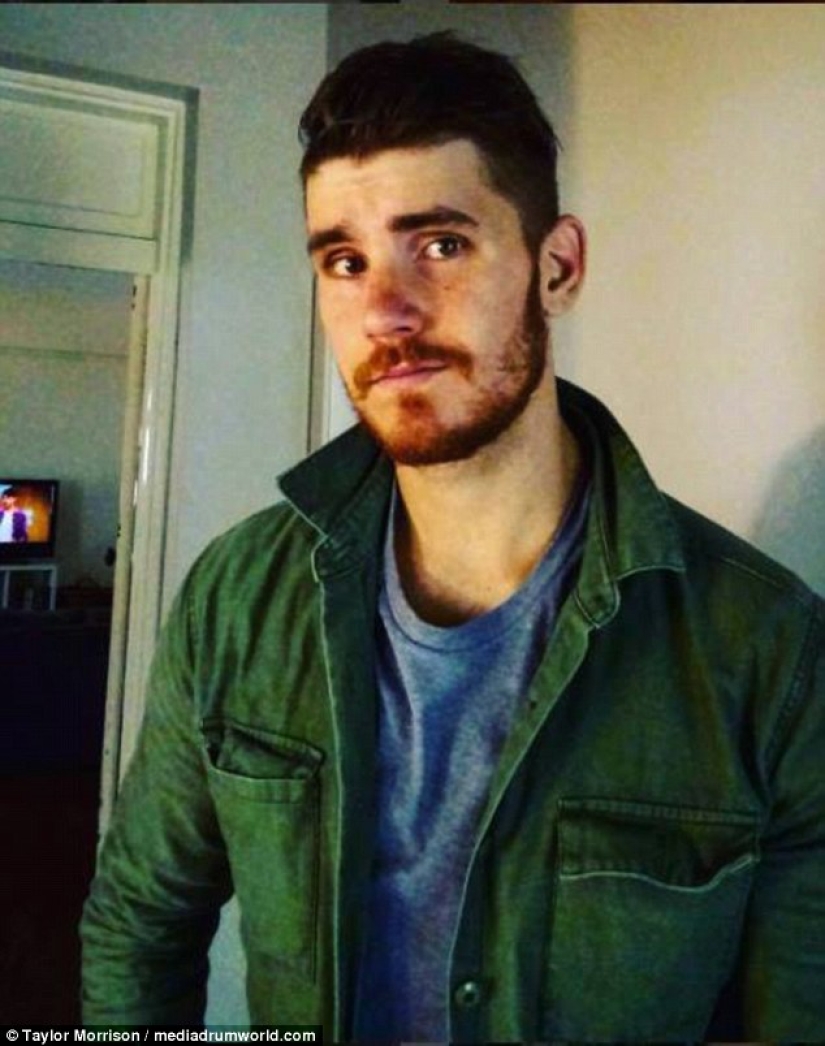 Everything is good in moderation: an obese man lost half his weight and became like Koshchei the Immortal Everything is good in moderation: an obese man lost half his weight and became like Koshchei the Immortal