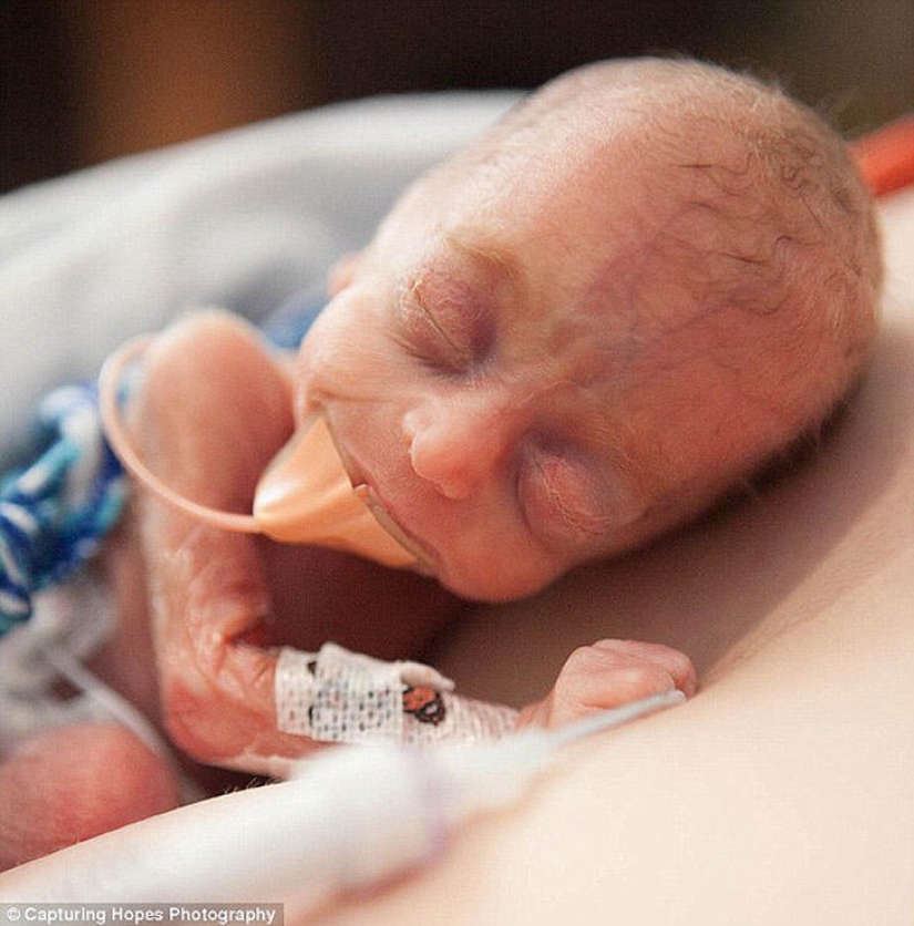 Fotografiando la esperanza