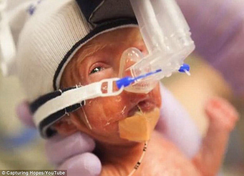 Fotografiando la esperanza