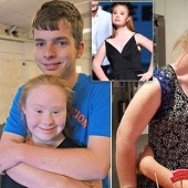 Fotos románticas de la modelo con síndrome de Down Madeleine Stewart y su novio