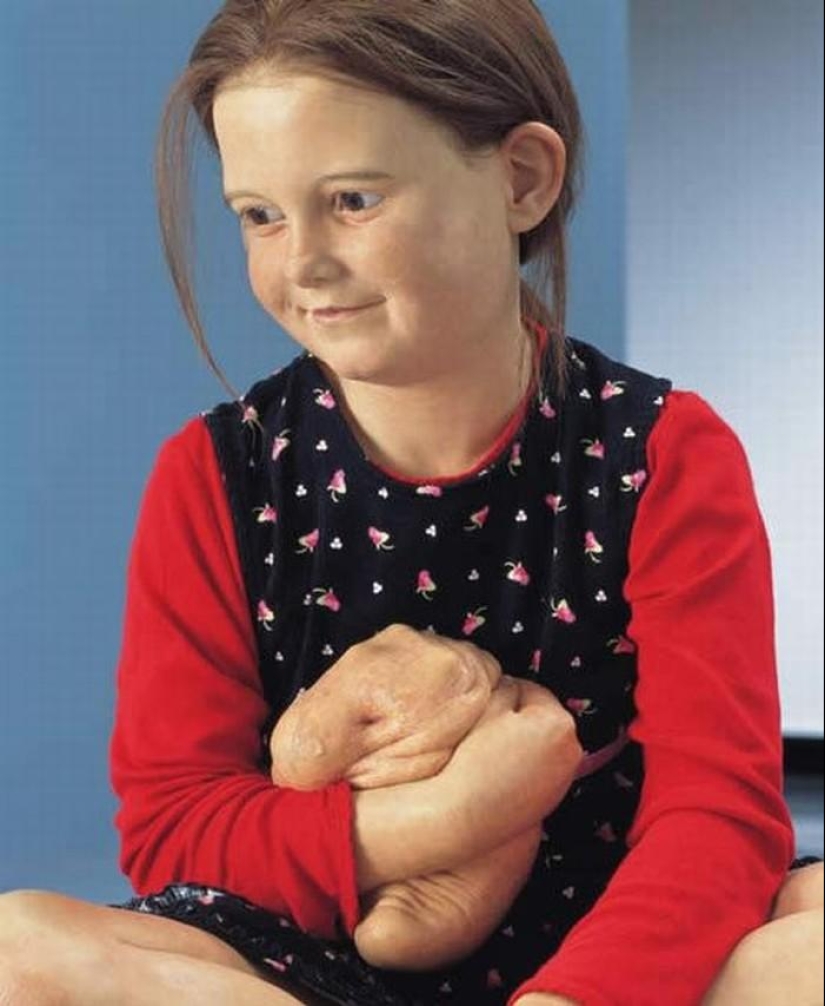 Gentiles monstruos de Patricia Piccinini