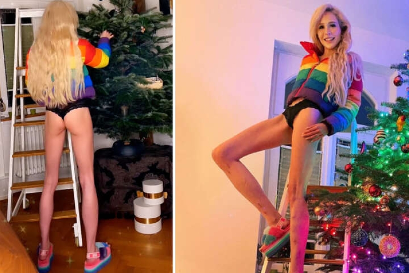 German model lengthened her legs by 14 cm and is not going to stop