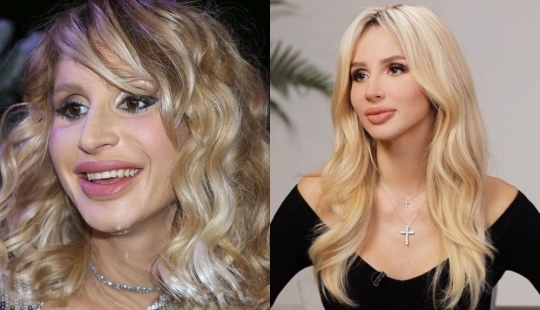 Getting plastic surgery was the best decision: 10 miraculous transformations of stars Getting plastic surgery was the best decision: 10 miraculous transformations of stars