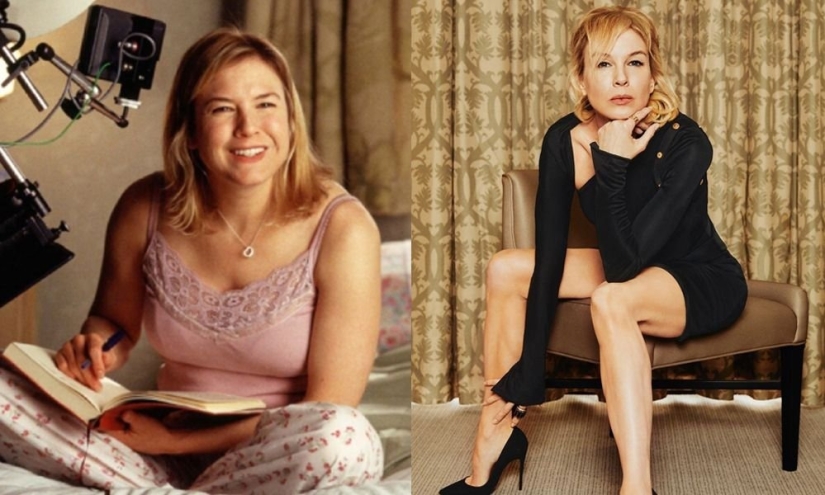 Getting plastic surgery was the best decision: 10 miraculous transformations of stars