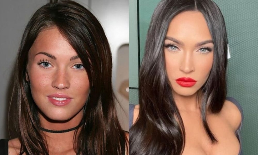 Getting plastic surgery was the best decision: 10 miraculous transformations of stars