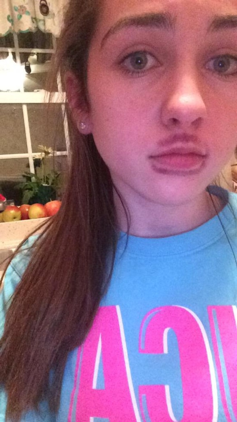 Girls try to make their lips plump like a TV star. It doesn't turn out very... Girls try to make their lips plump like a TV star. It doesn't turn out very...