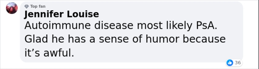 “Glad He Has A Sense Of Humor”: King Charles Roasts His Own Fingers In New BBC Documentary “Glad He Has A Sense Of Humor”: King Charles Roasts His Own Fingers In New BBC Documentary