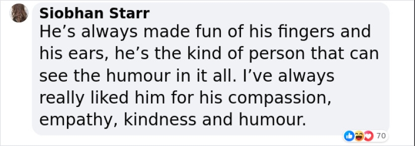 “Glad He Has A Sense Of Humor”: King Charles Roasts His Own Fingers In New BBC Documentary “Glad He Has A Sense Of Humor”: King Charles Roasts His Own Fingers In New BBC Documentary