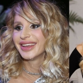 Hacerse una cirugía plástica fue la mejor decisión: 10 transformaciones milagrosas de estrellas