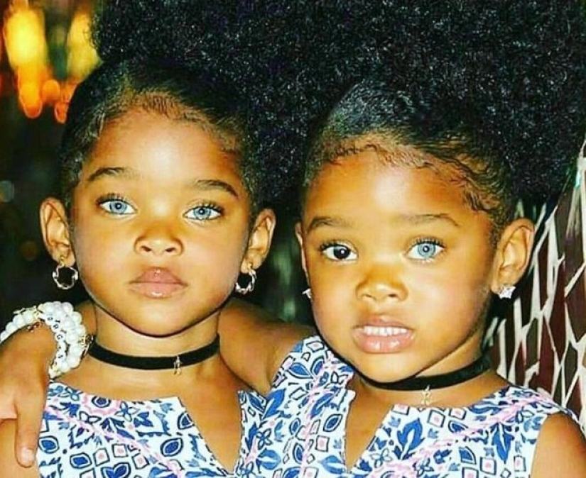 Han pasado 12 años, las hermanas gemelas con diferentes colores de ojos han crecido y se han convertido en bellezas. Han pasado 12 años, las hermanas gemelas con diferentes colores de ojos han crecido y se han convertido en bellezas.