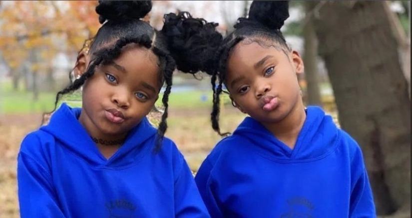 Han pasado 12 años, las hermanas gemelas con diferentes colores de ojos han crecido y se han convertido en bellezas. Han pasado 12 años, las hermanas gemelas con diferentes colores de ojos han crecido y se han convertido en bellezas.