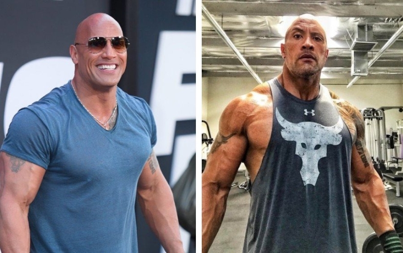 Hombres 9 estrellas que se han sometido a cirugía plástica: quiénes se pusieron más guapos y quiénes se arrepintieron