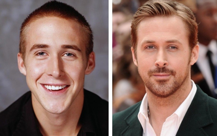 Hombres 9 estrellas que se han sometido a cirugía plástica: quiénes se pusieron más guapos y quiénes se arrepintieron