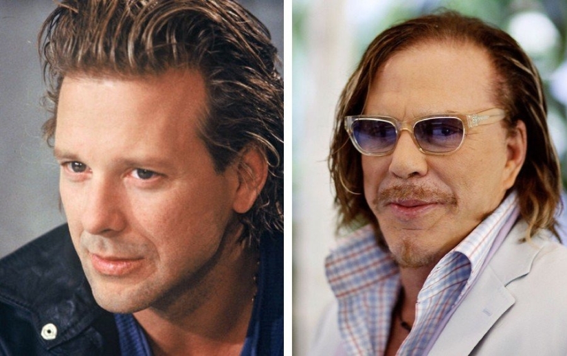 Hombres 9 estrellas que se han sometido a cirugía plástica: quiénes se pusieron más guapos y quiénes se arrepintieron