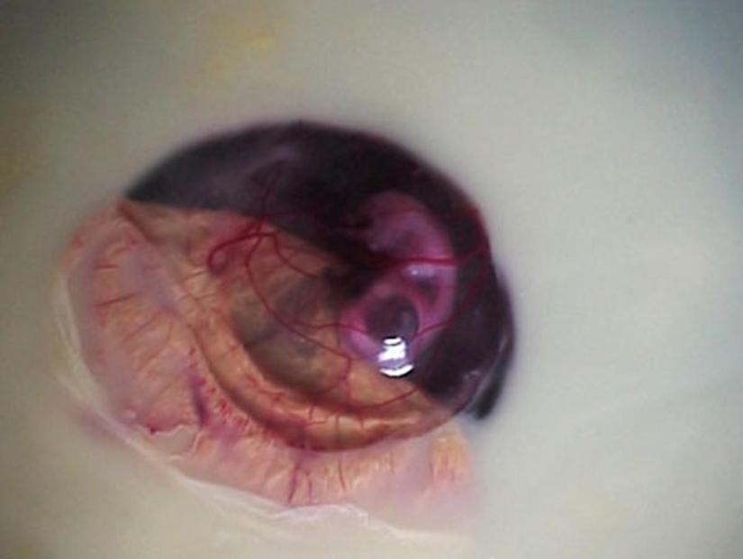 How a chicken develops from an egg