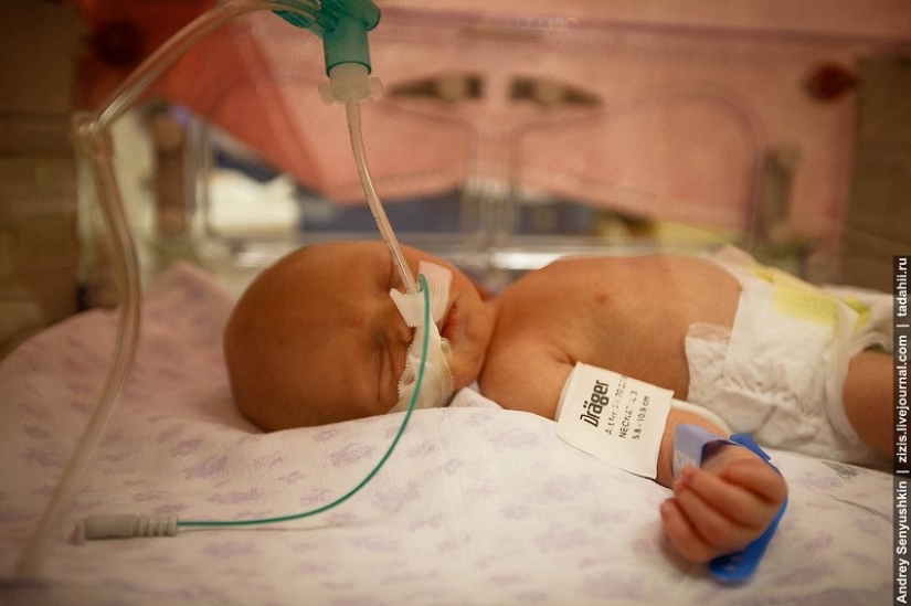 How are newborns saved? Report from pediatric intensive care