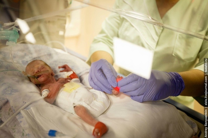 How are newborns saved? Report from pediatric intensive care