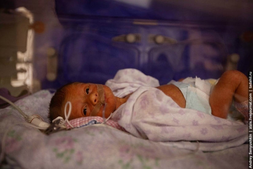 How are newborns saved? Report from pediatric intensive care