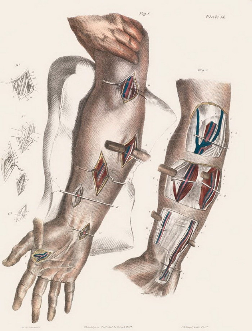 How were surgeries done at the beginning of the last century