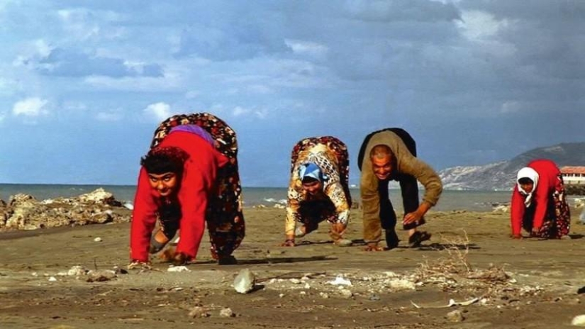 Impactantes mutaciones humanas Impactantes mutaciones humanas