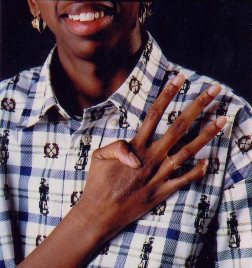 Impactantes mutaciones humanas Impactantes mutaciones humanas