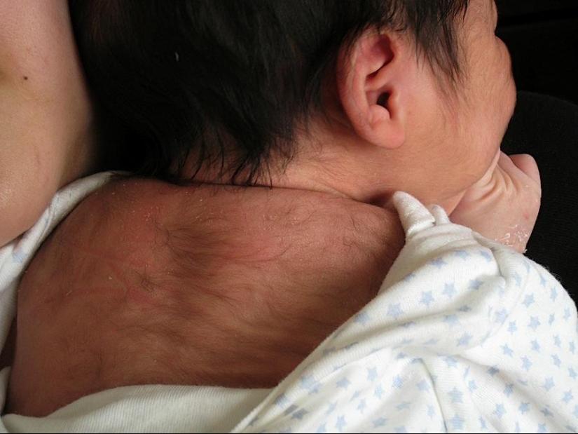 Impactantes mutaciones humanas Impactantes mutaciones humanas