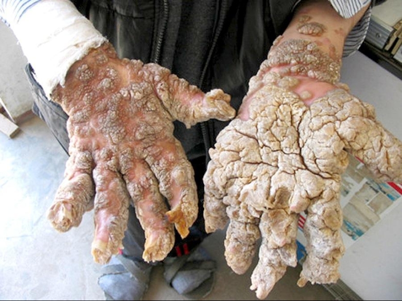 Impactantes mutaciones humanas Impactantes mutaciones humanas