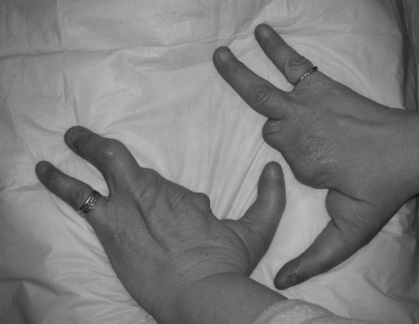 Impactantes mutaciones humanas Impactantes mutaciones humanas