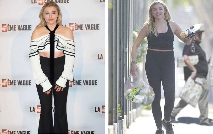 Imperfect from head to toe: 11 beauties in which at least one flaw is hidden